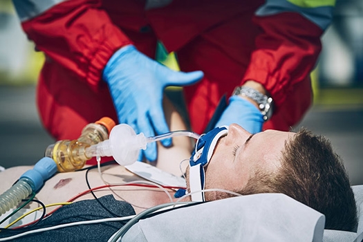 small intubation